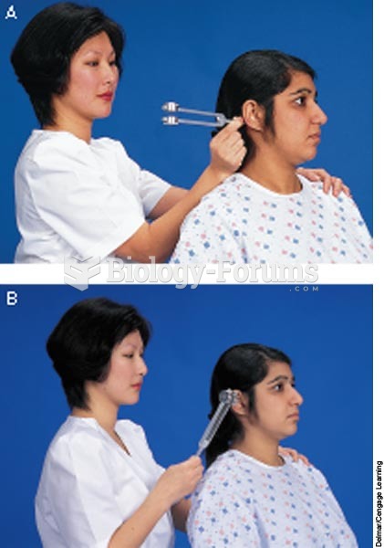 Rinne test: A. Place the base of the tuning fork on the mastoid process. B. Place tuning fork in fro