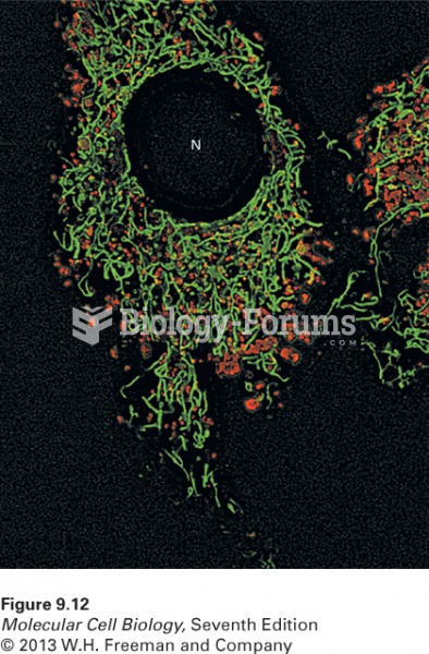 Location of lysosomes and mitochondria in a cultured living bovine pulmonary art