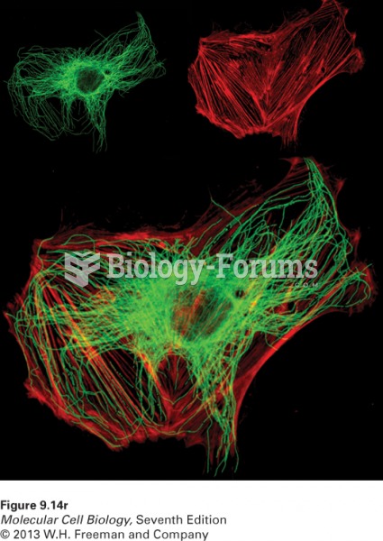 Double-label fluorescence microscopy can visualize the relative distributions of
