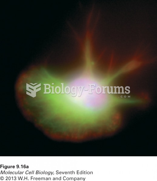 Deconvolution fluorescence microscopy yields high-resolution optical sections th