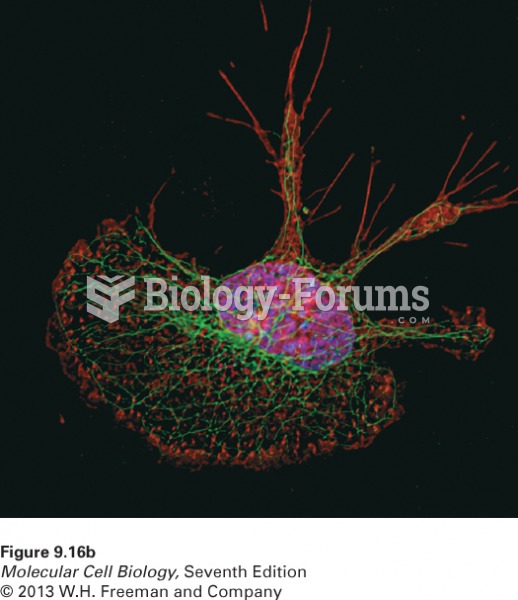 Deconvolution fluorescence microscopy yields high-resolution optical sections th