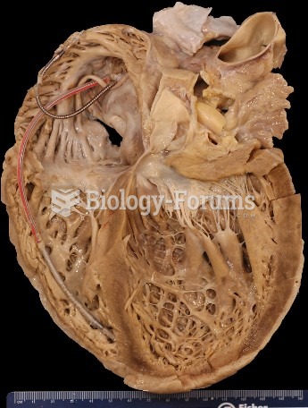 Cross section of heart with pacemaker leads