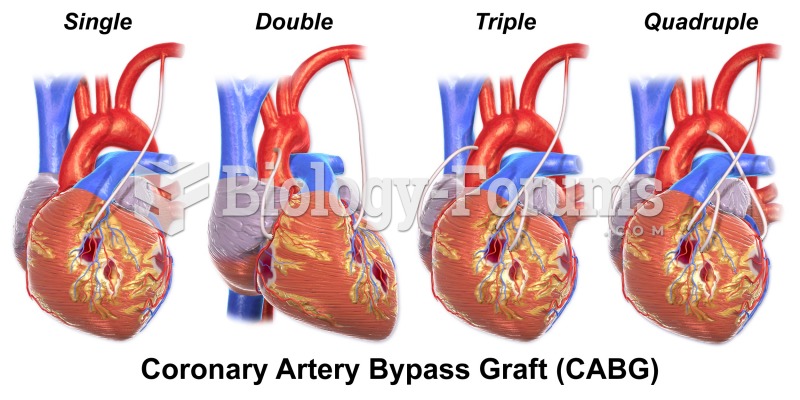 Pictures of Bypass (Heart)