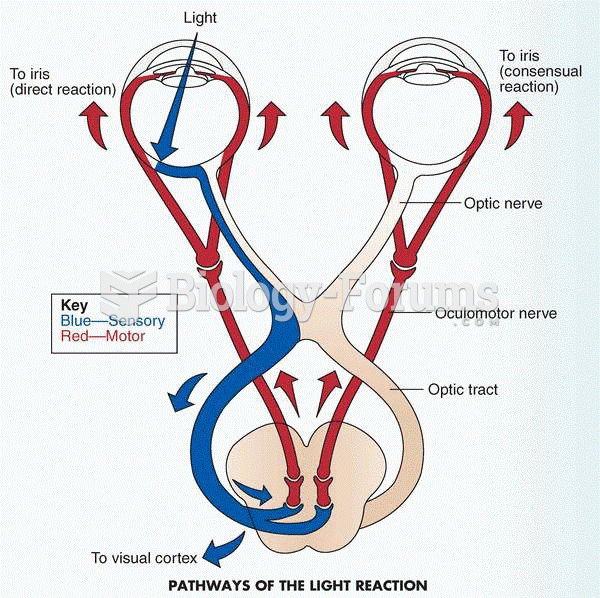 pupil light reaction