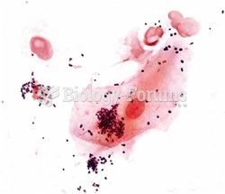Gram Stain of a person's Gum line