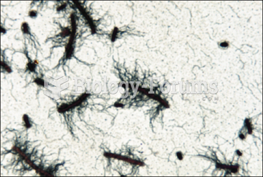 Flagella Stain- peitrichous arrangement
