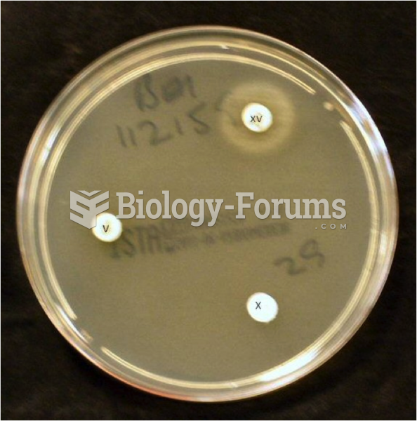 Nutrient Agar