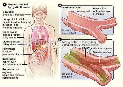 organs affected by cystic fibrosis