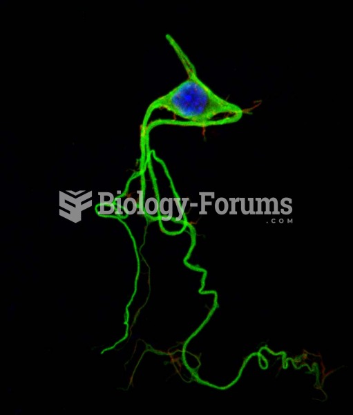 Neuron from Chicken embryo