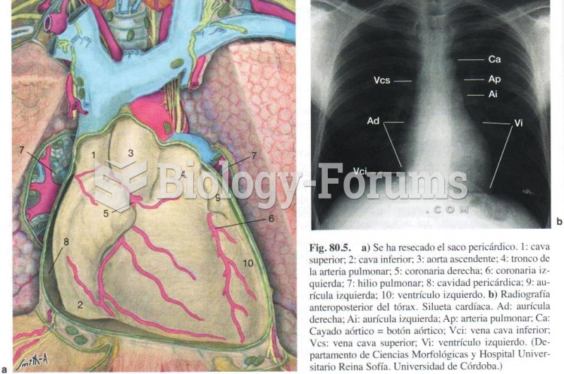 Heart Model 2