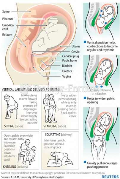 Childbirth possitions