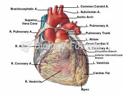 Anterior Heart