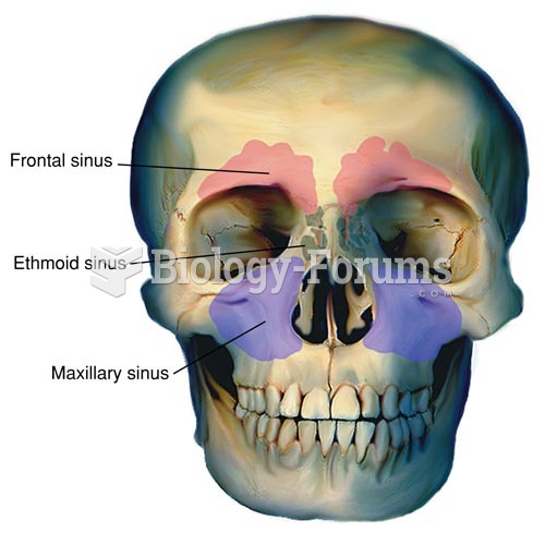 Location of the Sinuses (Sphenoid Sinuses are Directly Behind Ethmoid Sinuses)