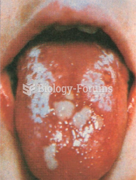 Tongue Conditions, Candidiasis (Thrush)