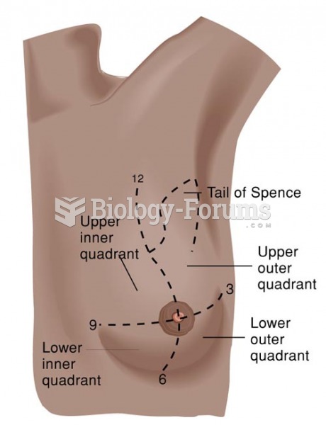 Quadrants of the Left Breast