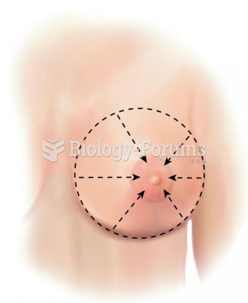 Breast Palpation Methods,  Wedge