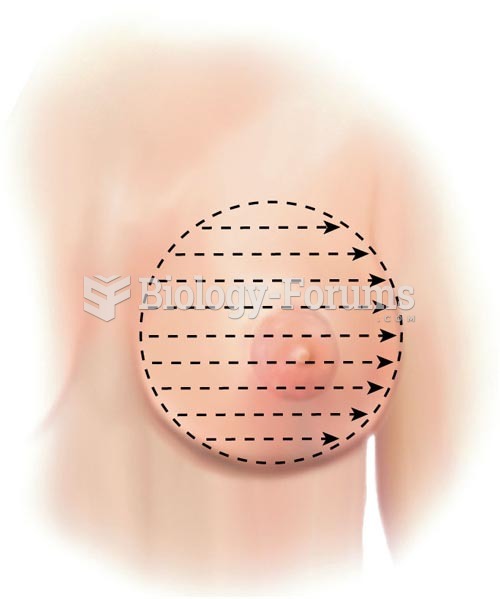 Breast Palpation Methods,  Parallel Lines