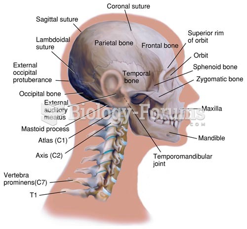 Bones of the Face and Skull (Lateral View)