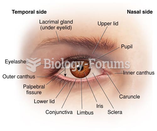 External View of the Right Eye