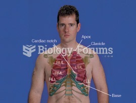 Lungs: RUL = Right Upper Lobe, RML = Right Middle Lobe, RLL = Right Lower Lobe, LUL = Left Upper Lob