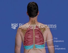 Lungs: RUL = Right Upper Lobe, RML = Right Middle Lobe, RLL = Right Lower Lobe, LUL = Left Upper Lob