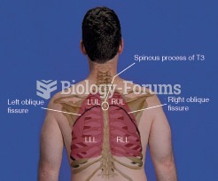 Lung Fissures, Posterior View
