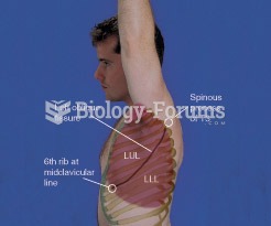 Lung Fissures, Left Lateral View