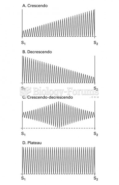 Characteristic Patterns of Murmurs, Crescendo, Decrescendo, Crescendo-decrescendo, Plateau
