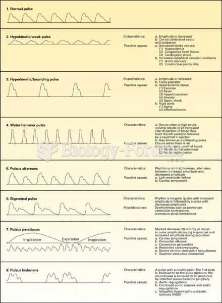 Alterations in Arterial Pulses