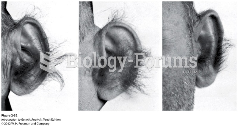 Hairy ears: a phenotype proposed to be Y linked