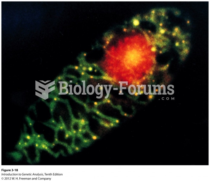 Cell showing nucleoids within mitochondria