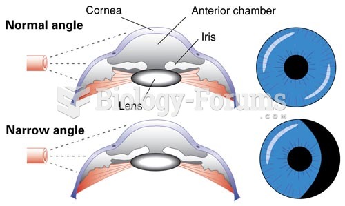 Evaluating the Angle of the Anterior Chamber