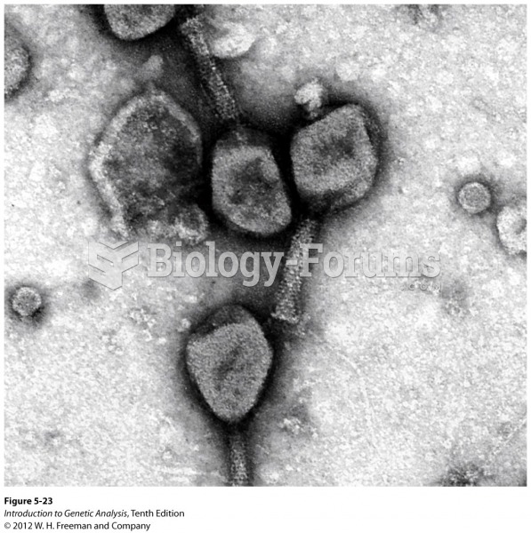Electron micrograph of phage T4