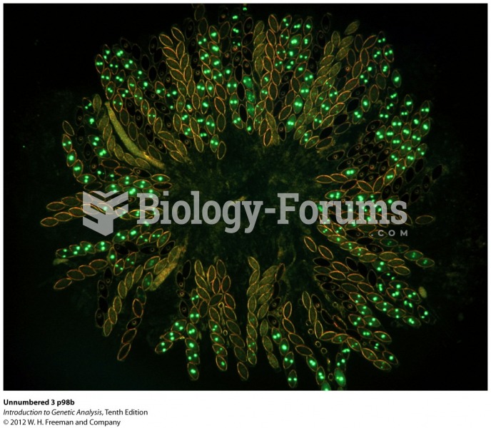 Model Organism Neurospora