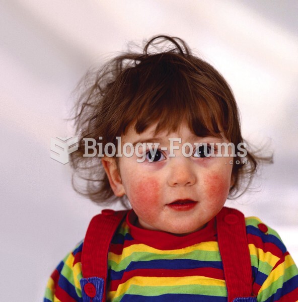 Infant Showing Signs of Fever