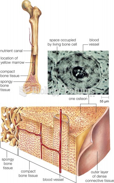 Cross-section through a Femur