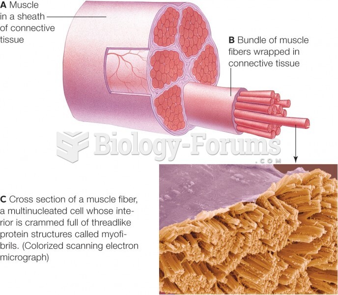 Structure of a skeletal muscle.