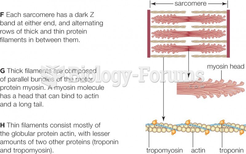 Structure of a skeletal muscle.