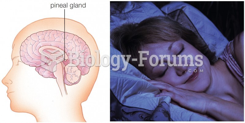 Location of the human pineal gland