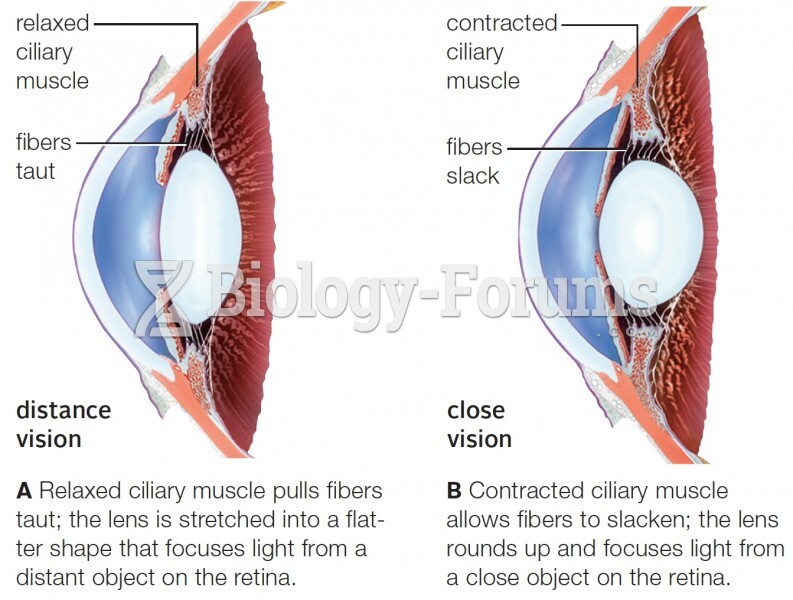 Pattern of retinal stimulation in the human eye