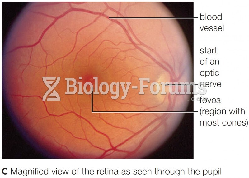 Magnified view of the retina as seen through the pupil