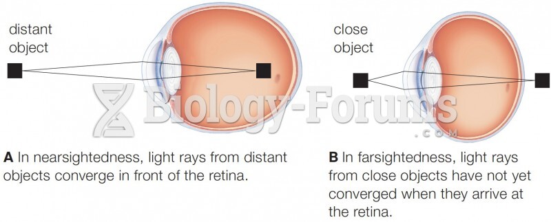 Focusing problems. 