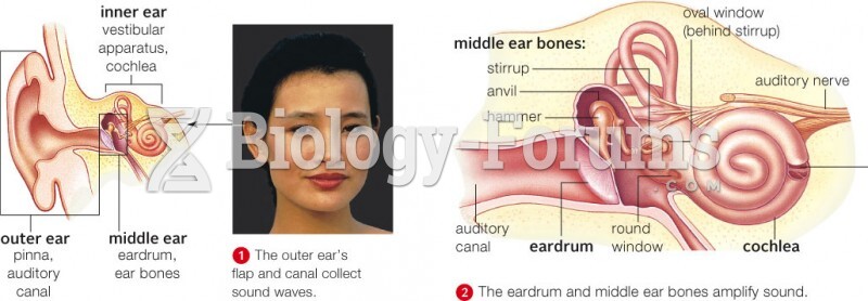 Anatomy of the ear and how we hear.