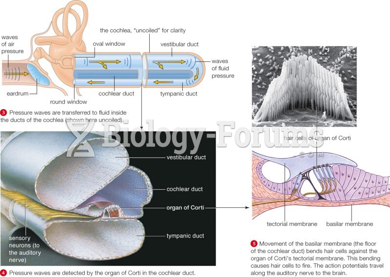 Anatomy of the ear and how we hear