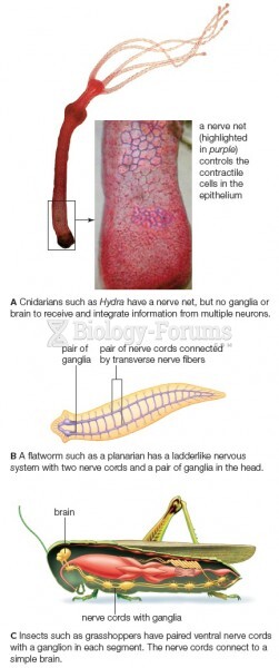 Examples of invertebrate nervous systems