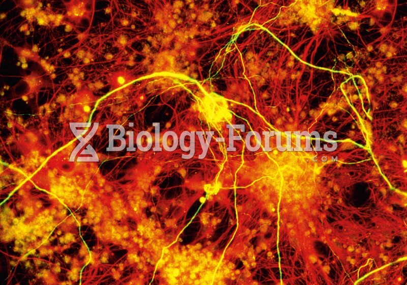 Neuron and Astrocytes