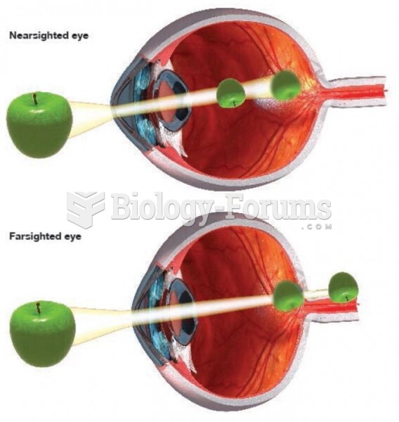 Structure of the Eye (near-sighted vs far-sighted)