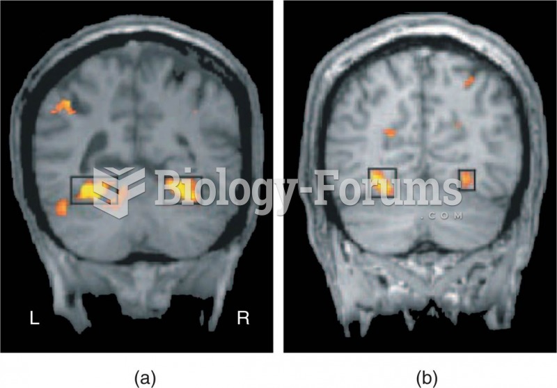 The Parahippocampal Place Area 