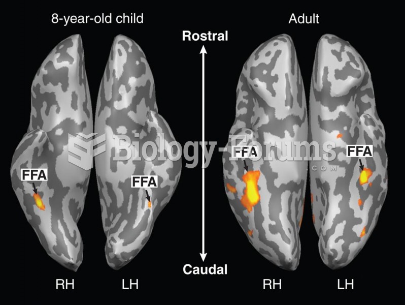 Fusiform Gyrus Responses to Faces 