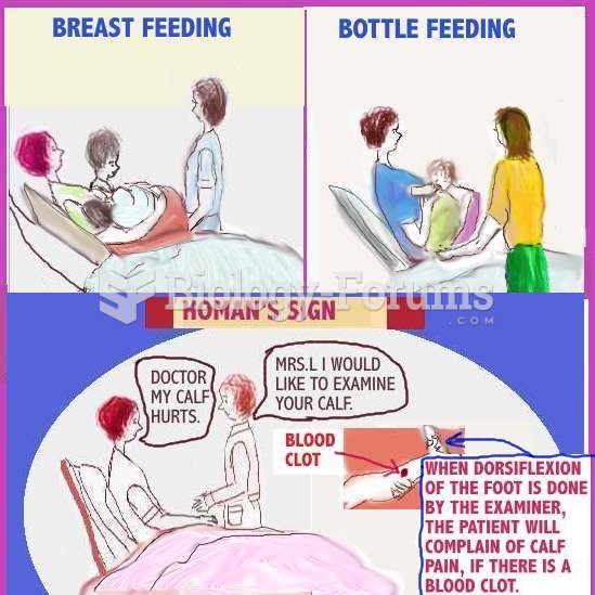 Homans Sign Maternal Nursing